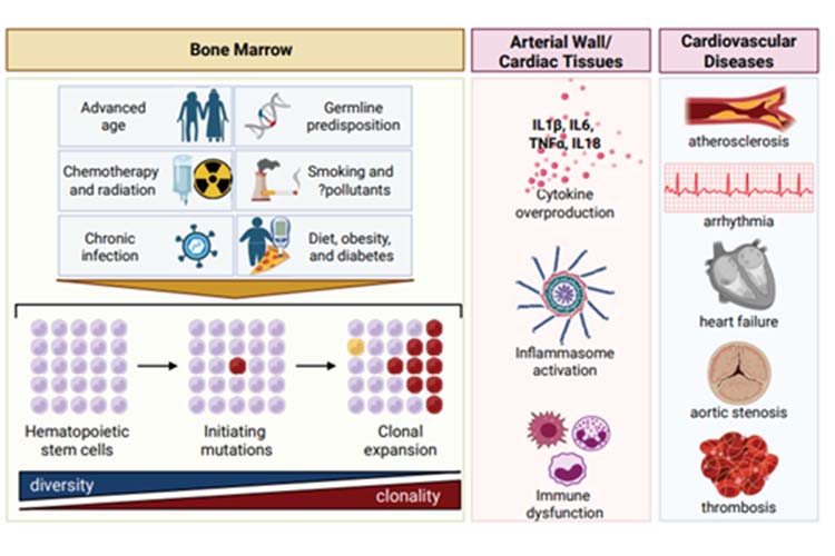 Figure 1 Clonal Hematopoiesis and Its Cardiovascular Implications