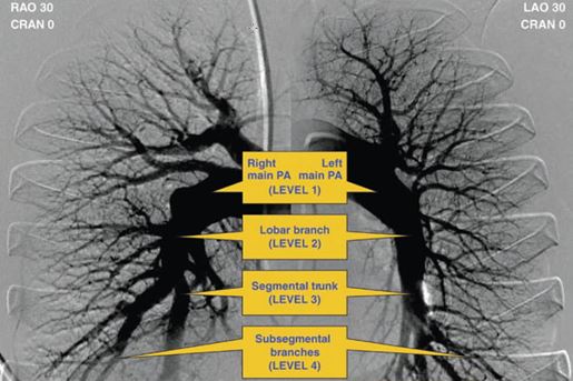 anatomical disease level classification on NS-IPA for routine clinical practive