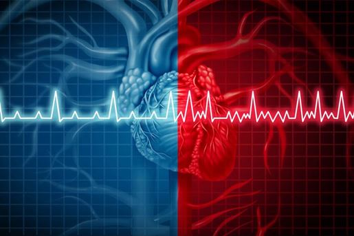 Atrial Fibrillation Atrial Fibrillation