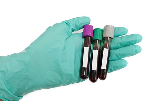 hand with latex glove holding blood sample