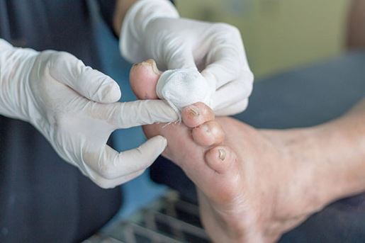 infected wound of diabetic foot
