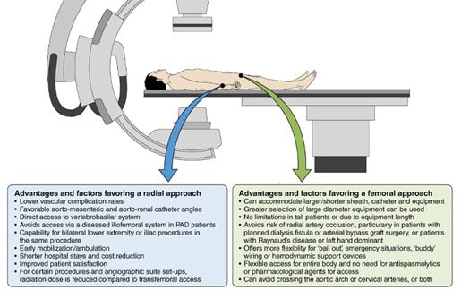 radial and femoral approach